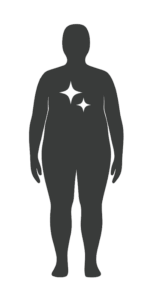 Meilenstein-Figur