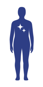 Meilenstein-Figur