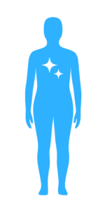 Meilenstein-Figur